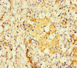 TBC1D24 Antibody - Immunohistochemistry of paraffin-embedded human pancreatic tissue at dilution of 1:100