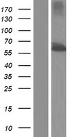 TBC1D24 Protein - Western validation with an anti-DDK antibody * L: Control HEK293 lysate R: Over-expression lysate