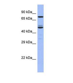 TBC1D25 Antibody - Western blot of Human Fetal Small Intestine. TBC1D25 antibody dilution 1.0 ug/ml.  This image was taken for the unconjugated form of this product. Other forms have not been tested.