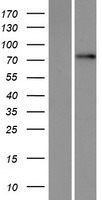TBC1D25 Protein - Western validation with an anti-DDK antibody * L: Control HEK293 lysate R: Over-expression lysate