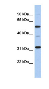 TBC1D26 Antibody - TBC1D26 antibody Western blot of Fetal Kidney lysate. This image was taken for the unconjugated form of this product. Other forms have not been tested.