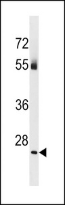 TBC1D26 Antibody - TBC1D26 Antibody western blot of human placenta tissue lysates (35 ug/lane). The TBC1D26 antibody detected the TBC1D26 protein (arrow).