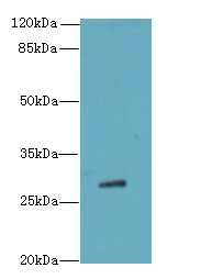 TBC1D26 Antibody - Western blot. All lanes: TBC1D26 antibody at 3 ug/ml+Mos- liver tissue Goat polyclonal to rabbit at 1:10000 dilution. Predicted band size: 29 kDa. Observed band size: 29 kDa.
