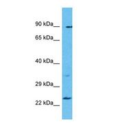 TBC1D28 Antibody - Western blot of Human Uterus Tumor. TBC1D28 antibody dilution 1.0 ug/ml.  This image was taken for the unconjugated form of this product. Other forms have not been tested.