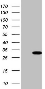 TBC1D28 Antibody - HEK293T cells were transfected with the pCMV6-ENTRY control (Left lane) or pCMV6-ENTRY TBC1D28 (Right lane) cDNA for 48 hrs and lysed. Equivalent amounts of cell lysates (5 ug per lane) were separated by SDS-PAGE and immunoblotted with anti-TBC1D28 (1:2000).