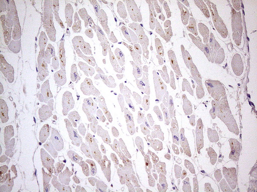 TBC1D28 Antibody - IHC of paraffin-embedded Human adult heart tissue using anti-TBC1D28 mouse monoclonal antibody. (Heat-induced epitope retrieval by 1 mM EDTA in 10mM Tris, pH8.5, 120°C for 3min)(1:150).