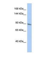 TBC1D2B Antibody - Western blot of Human HepG2. TBC1D2B antibody dilution 1.0 ug/ml.  This image was taken for the unconjugated form of this product. Other forms have not been tested.