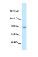 TBC1D2B Antibody - TBC1D2B antibody Western blot of PANC1 Cell lysate. Antibody concentration 1 ug/ml.  This image was taken for the unconjugated form of this product. Other forms have not been tested.