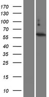 TBC1D3 Protein - Western validation with an anti-DDK antibody * L: Control HEK293 lysate R: Over-expression lysate