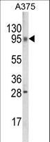 TBC1D32 / C6orf170 Antibody - Western blot of C6orf170 Antibody in A375 cell line lysates (35 ug/lane). C6orf170 (arrow) was detected using the purified antibody.