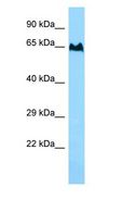 TBC1D3F Antibody - TBC1D3F antibody Western Blot of MCF7.  This image was taken for the unconjugated form of this product. Other forms have not been tested.