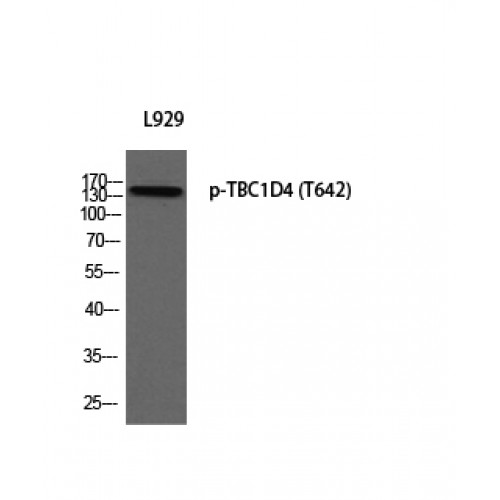 TBC1D4 / AS160 Antibody - Western blot of Phospho-TBC1D4 (T642) antibody