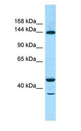 TBC1D4 / AS160 Antibody - TBC1D4 / AS160 antibody Western Blot of 721_B.  This image was taken for the unconjugated form of this product. Other forms have not been tested.