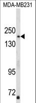 TBC1D4 / AS160 Antibody - Western blot of TBC1D4 Antibody in MDA-MB231 cell line lysates (35 ug/lane). TBC1D4 (arrow) was detected using the purified antibody.
