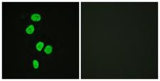 TBC1D4 / AS160 Antibody - Immunofluorescence analysis of HeLa cells, using AS160 Antibody. The picture on the right is blocked with the synthesized peptide.
