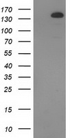 TBC1D4 / AS160 Antibody - HEK293T cells were transfected with the pCMV6-ENTRY control (Left lane) or pCMV6-ENTRY TBC1D4 (Right lane) cDNA for 48 hrs and lysed. Equivalent amounts of cell lysates (5 ug per lane) were separated by SDS-PAGE and immunoblotted with anti-TBC1D4.