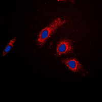 TBC1D4 / AS160 Antibody - Immunofluorescent analysis of AS160 staining in HeLa cells. Formalin-fixed cells were permeabilized with 0.1% Triton X-100 in TBS for 5-10 minutes and blocked with 3% BSA-PBS for 30 minutes at room temperature. Cells were probed with the primary antibody in 3% BSA-PBS and incubated overnight at 4 deg C in a humidified chamber. Cells were washed with PBST and incubated with a DyLight 594-conjugated secondary antibody (red) in PBS at room temperature in the dark. DAPI was used to stain the cell nuclei (blue).