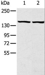 TBC1D4 / AS160 Antibody - Western blot analysis of HeLa and hepg2 cell, using TBC1D4 Polyclonal Antibody at dilution of 1:320.