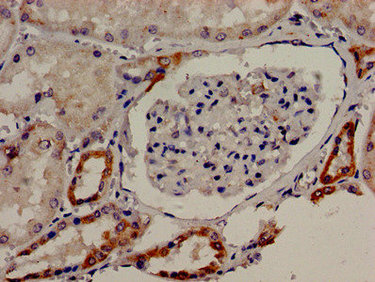 TBC1D4 / AS160 Antibody - Immunocytochemistry analysis of human kidney tissue at a dilution of 1:100