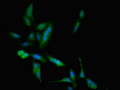 TBC1D4 / AS160 Antibody - Immunofluorescent analysis of Hela cells at a dilution of 1:100 and Alexa Fluor 488-congugated AffiniPure Goat Anti-Rabbit IgG(H+L)