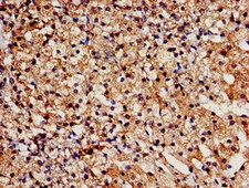 TBC1D4 / AS160 Antibody - Immunohistochemistry analysis of human adrenal gland tissue at a dilution of 1:100