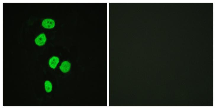 TBC1D4 / AS160 Antibody - Peptide - + Immunofluorescence analysis of HeLa cells, using AS160 (Ab-642) antibody.
