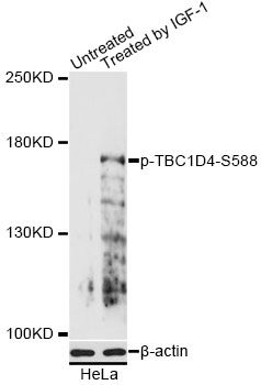 TBC1D4 / AS160 Antibody - Western blot analysis of extracts of HeLa cells, using Phospho-TBC1D4-S588 antibody at 1:2000 dilution. HeLa cells were treated by IGF-1 (50ng/ml) for 30 minutes after serum-starvation overnight. The secondary antibody used was an HRP Goat Anti-Rabbit IgG (H+L) at 1:10000 dilution. Lysates were loaded 25ug per lane and 3% nonfat dry milk in TBST was used for blocking. Blocking buffer: 3% BSA.An ECL Kit was used for detection and the exposure time was 30s.