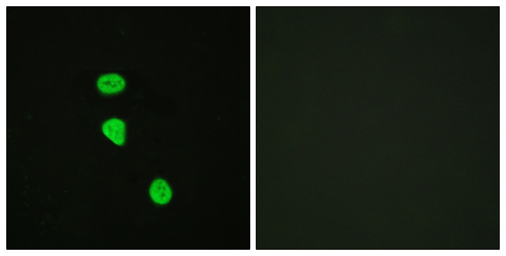 TBC1D4 / AS160 Antibody - Immunofluorescence analysis of HeLa cells, using AS160 (Phospho-Thr642) Antibody. The picture on the right is blocked with the phospho peptide.