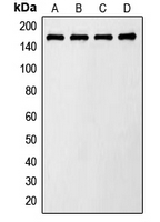 TBC1D4 / AS160 Antibody - Western blot analysis of AS160 (pT642) expression in LO2 insulin-treated (A); Raw264.7 insulin-treated (B); PC12 insulin-treated (C); NIH3T3 UV-treated (D) whole cell lysates.