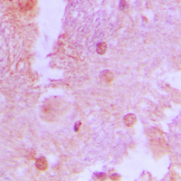 TBC1D4 / AS160 Antibody - Immunohistochemical analysis of AS160 (pT642) staining in human brain formalin fixed paraffin embedded tissue section. The section was pre-treated using heat mediated antigen retrieval with sodium citrate buffer (pH 6.0). The section was then incubated with the antibody at room temperature and detected using an HRP conjugated compact polymer system. DAB was used as the chromogen. The section was then counterstained with hematoxylin and mounted with DPX.