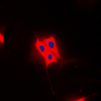 TBC1D4 / AS160 Antibody - Immunofluorescent analysis of AS160 (pT642) staining in Raw264.7 cells. Formalin-fixed cells were permeabilized with 0.1% Triton X-100 in TBS for 5-10 minutes and blocked with 3% BSA-PBS for 30 minutes at room temperature. Cells were probed with the primary antibody in 3% BSA-PBS and incubated overnight at 4 C in a humidified chamber. Cells were washed with PBST and incubated with a DyLight 594-conjugated secondary antibody (red) in PBS at room temperature in the dark. DAPI was used to stain the cell nuclei (blue).