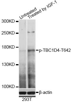 TBC1D4 / AS160 Antibody - Western blot analysis of extracts of 293T cells, using Phospho-TBC1D4-T642 antibody at 1:2000 dilution. 293T cells were treated by IGF-1 (50ng/ml) for 5 minutes after serum-starvation overnight. The secondary antibody used was an HRP Goat Anti-Rabbit IgG (H+L) at 1:10000 dilution. Lysates were loaded 25ug per lane and 3% nonfat dry milk in TBST was used for blocking. Blocking buffer: 3% BSA.An ECL Kit was used for detection and the exposure time was 30s.