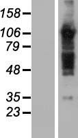 TBC1D5 Protein - Western validation with an anti-DDK antibody * L: Control HEK293 lysate R: Over-expression lysate