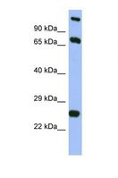 TBC1D7 Antibody - Western blot of Human Fetal Brain. TBC1D7 antibody dilution 1.0 ug/ml.  This image was taken for the unconjugated form of this product. Other forms have not been tested.