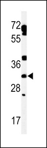 TBC1D7 Antibody - Western blot of lysate from human heart tissue lysate, using TBCD7 Antibody. Antibody was diluted at 1:1000 at each lane. A goat anti-rabbit IgG H&L (HRP) at 1:5000 dilution was used as the secondary antibody. Lysate at 35ug per lane.