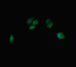 TBC1D7 Antibody - Immunofluorescent analysis of HepG-2 cells diluted at 1:100 and Alexa Fluor 488-congugated AffiniPure Goat Anti-Rabbit IgG(H+L)