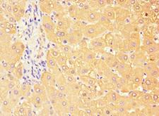TBC1D7 Antibody - Immunohistochemistry of paraffin-embedded human liver tissue at dilution 1:100