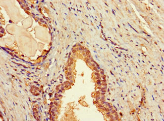 TBC1D7 Antibody - Immunohistochemistry of paraffin-embedded human prostate tissue at dilution 1:100