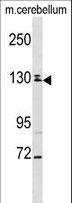 TBC1D8 / AD3 Antibody - TBC1D8 Antibody western blot of mouse cerebellum tissue lysates (35 ug/lane). The TBC1D8 antibody detected the TBC1D8 protein (arrow).