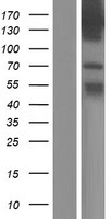TBC1D9 Protein - Western validation with an anti-DDK antibody * L: Control HEK293 lysate R: Over-expression lysate