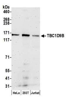 TBC1D9B Antibody - Detection of human TBC1D9B by western blot. Samples: Whole cell lysate (50 µg) from HeLa, HEK293T, and Jurkat cells prepared using NETN lysis buffer. Antibodies: Affinity purified rabbit anti-TBC1D9B antibody used for WB at 0.1 µg/ml. Detection: Chemiluminescence with an exposure time of 3 minutes.
