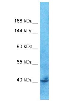 TBC1D9B Antibody - TBC1D9B antibody Western Blot of ACHN. Antibody dilution: 1 ug/ml.  This image was taken for the unconjugated form of this product. Other forms have not been tested.
