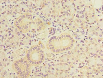 TBC1D9B Antibody - Immunohistochemistry of paraffin-embedded human pancreatic tissue using antibody at dilution of 1:100.