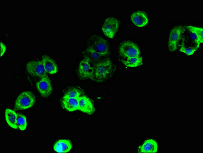 TBC1D9B Antibody - Immunofluorescent analysis of A431 cells using TBC1D9B Antibody at dilution of 1:100 and Alexa Fluor 488-congugated AffiniPure Goat Anti-Rabbit IgG(H+L)