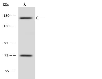TBC1D9B Antibody - Anti-TBC1D9B rabbit polyclonal antibody at 1:500 dilution. Lane A: Jurkat Whole Cell Lysate. Lysates/proteins at 30 ug per lane. Secondary: Goat Anti-Rabbit IgG (H+L)/HRP at 1/10000 dilution. Developed using the ECL technique. Performed under reducing conditions. Predicted band size: 141 kDa. Observed band size: 170 kDa.