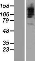 TBC1D9B Protein - Western validation with an anti-DDK antibody * L: Control HEK293 lysate R: Over-expression lysate