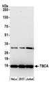 TBCA Antibody - Detection of human TBCA by western blot. Samples: Whole cell lysate (15 µg) from HeLa, HEK293T, and Jurkat cells prepared using NETN lysis buffer. Antibody: Affinity purified rabbit anti-TBCA antibody used for WB at 0.1 µg/ml. Detection: Chemiluminescence with an exposure time of 75 seconds.