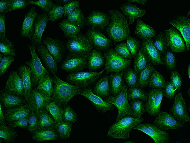 TBCA Antibody - Immunofluorescence staining of TBCA in U2OS cells. Cells were fixed with 4% PFA, permeabilzed with 0.1% Triton X-100 in PBS, blocked with 10% serum, and incubated with rabbit anti-Human TBCA polyclonal antibody (dilution ratio 1:200) at 4°C overnight. Then cells were stained with the Alexa Fluor 488-conjugated Goat Anti-rabbit IgG secondary antibody (green) and counterstained with DAPI (blue). Positive staining was localized to Nucleus and Cytoplasm.