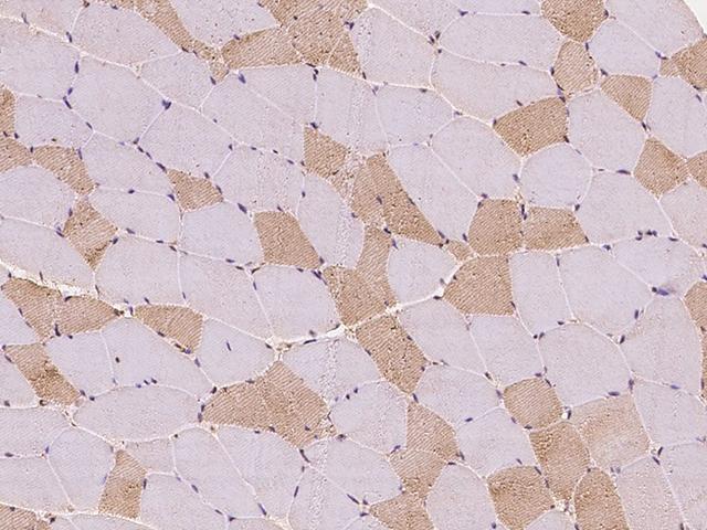 TBCA Antibody - Immunochemical staining of human TBCA in human skeletal muscle with rabbit polyclonal antibody at 1:100 dilution, formalin-fixed paraffin embedded sections.