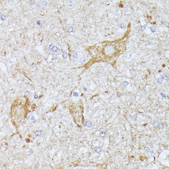 TBCA Antibody - Immunohistochemistry of paraffin-embedded Mouse spinal cord using TBCA Polyclonal Antibody at dilution of 1:100 (40x lens).